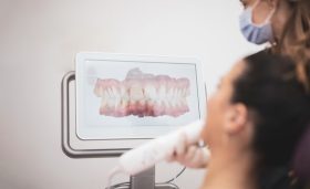 DentalScanning_1 DentalScanning_1